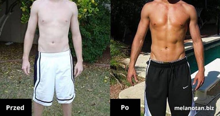 przed i po zastosowaniu melatonanu 2